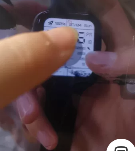 OPPO watch 1。41mm，esi...