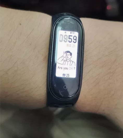 小米手环5有轻微划痕 不常使用掉地上划了一...