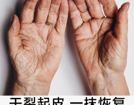 转卖【买二送一】手脚干裂一抹恢复去手部角质...